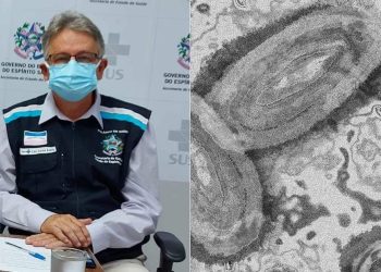 VÍDEO | Varíola dos macacos: subsecretário fala sobre caso investigado no Espírito Santo
