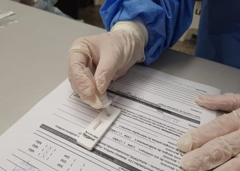 Positividade de testes para detecção da Covid-19 volta a crescer e é maior dos últimos quatro meses