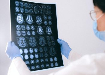 Dia Nacional de Conscientização do Alzheimer: prevenção e tratamentos