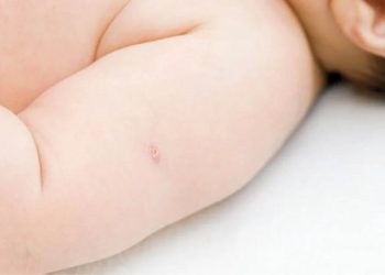 Estado tem segundo ano consecutivo de alcance da meta vacinal da BCG